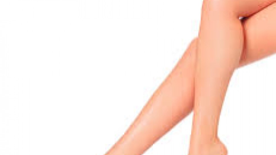 Spider veins and sclerotherapy